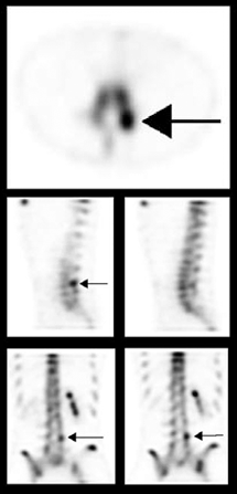 clinical study 1